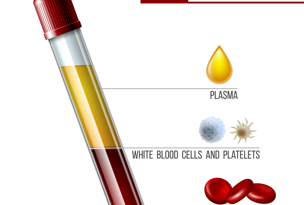 Platelet Rich Fibrin