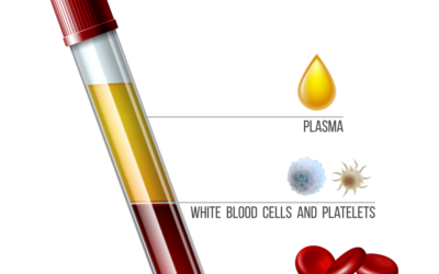 Platelet Rich Fibrin