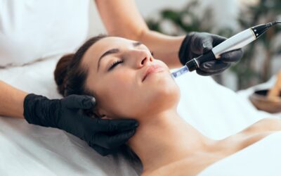 What Are the Benefits of SkinPen Microneedling?