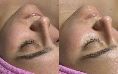 Aquafirme XS Facial