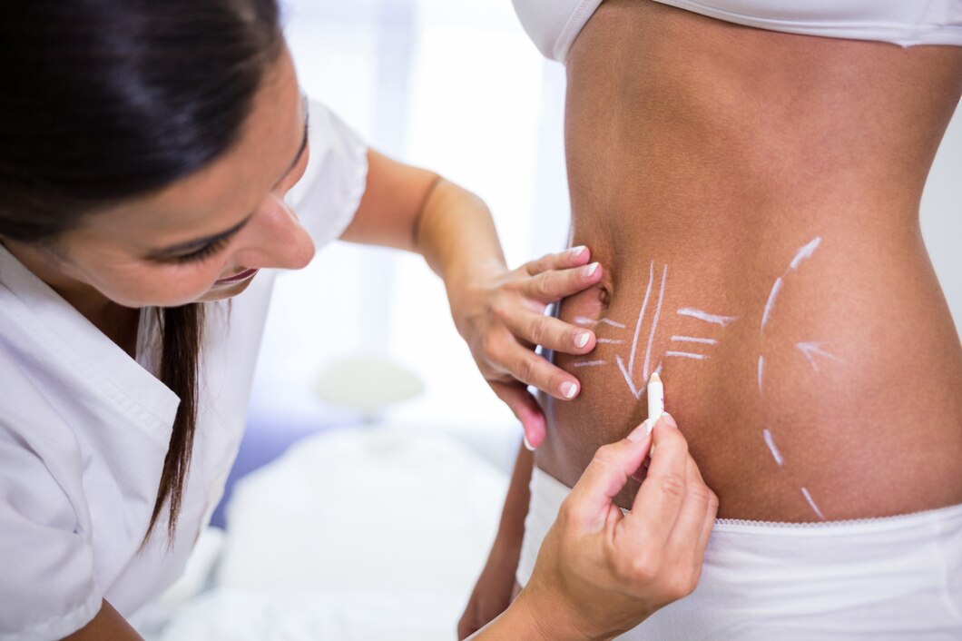 Body Contouring services in Fort Myers FL